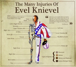 Liste des blessures d'Evel Knievel
