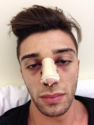 MotoGP : Iannone opérée avec succès (crédit photo : DR)