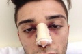 MotoGP Iannone opéré succès